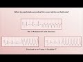 Advanced EKGs - Distinguishing VT from SVT with aberrancy