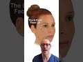 Will the 8-Point Facelift Give a “Done” Look? | Natural and Subtle Results Explained