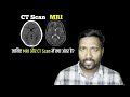 CT Scan और MRI में क्या अंतर होता है? | Difference between CT Scan and MRI | CT SCAN Vs MRI