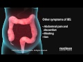 Irritable Bowel Syndrome (IBS)