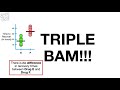 Hypothesis Testing and The Null Hypothesis, Clearly Explained!!!