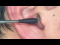 耳かき動画　チョロ毛０１ Earwax Ear cleaning 洗耳 귀이개