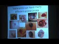 Early Detection of Melanoma