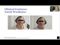 Updates in Facioscapulohumeral Muscular Dystrophy (FSHD)