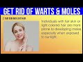 10 PROVEN Natural Remedies To Get Rid Of Warts & Moles For Good!