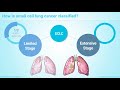 Staging of Lung Cancer