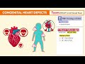 Tetralogy of Fallot Defect | Congenital Heart Defects Nursing