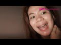DIY How to use Derma Roller BEGINNERS | April Bautista