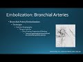 Embolization Bronchial Artery 2020