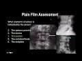 Cervical Spine X-Ray