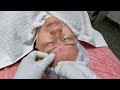 DERMAPEN + TOXINA BOTULÍNICA 🔥 Lo mejor para ARRUGAS FACIALES?✅ CURSO GRATIS 💪👨‍⚕