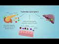 SIBO & IBS Caused By VITAMIN DEFICIENCY?