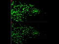 Superresolution Airyscan versus LSM Confocal