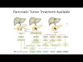 Pancreatic Tumor Available Treatments and Median Survival Time #Code: 380