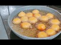 Amazing Potato Recipes | Crispy Potatoes | Potato Snacks | French Fries | Easy Recipes #viral