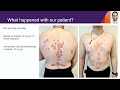 Challenging Case: A Patient with Infection | Lucas Galimany, MD, MSc | Chile