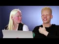 People With Albinism Review Albino Characters From Film