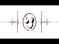 KillyKid - Gaster Theme Remix (Official audio)