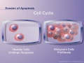 The Pathophysiology of Non-small Cell Lung Cancer