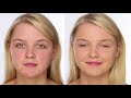 Acne/Blemish Covering Makeup - My Pinpoint Concealer Technique