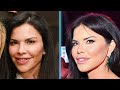 Lauren Sanchez's NEW FACE | Plastic Surgery Analysis