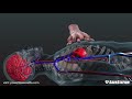 CPR in Action | A 3D look inside the body