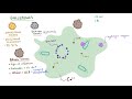 Gallstones | Clinical Presentation