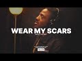 [FREE] Mozzy Type Beat – WEAR MY SCARS (prod. Hokatiwi) | Yatta Type Beat