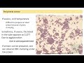 Hemolytic Anemias- Part 8: Immune Hemolytic Anemia (IHA)