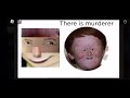 Roblox ugly face lore