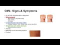 Chronic Myeloid Leukemia (CML) | Pathogenesis, Symptoms and Treatment