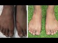 दुनिया का सबसे आसान तरीका जो हाथ पैर गर्दन को चमका देगा, 1 ही बार में 100% Result | Feet Brightening