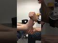 Ankle Fusion Patient 5 Months After Operation Showing Foot's Range of  Motion