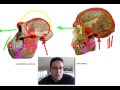 Skullcast: comparison of hominin skulls