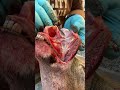 Proper Caping/Releasing nose & lips from skull (Segment 7)