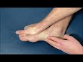 How to Fix BIG TOE Pain for Good