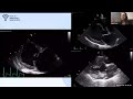 VVS Cardiology Webinar- 'Basic Echocardiography' with Dr Brigite Pedro