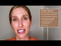 Dermatologist's Morning Skincare Routine for Melasma & Hyperpigmentation! | Dr. Sam Ellis