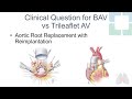 Aortic Valve Surgery: When to Perform Ross Procedure, Repair/Replace with Root Management (Graphic)