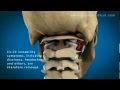 C1 and C2 Atlantoaxial Instability: Upper Cervical Instability and Prolotherapy animation