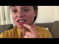 I had jaw surgery!!!! First two weeks of recovery vlog