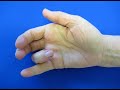 Hand Injection Techniques - Trigger Finger