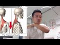 Neck shoulder pain causes: upper trapezius treatment massage and exercises