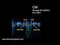 Echocardiography Standard Protocol | Step by Step | Complete Trans-thoracic Normal Echocardiogram