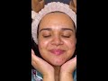 Face shaving for acne prone skin | Prisha Mudgal #shorts #faceshaving #acneproneskin