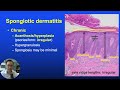 DERMATOPATHOLOGY: Spongiotic Dermatitis