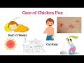 Chicken Pox causes, Symptoms and Treatment