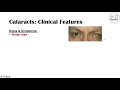 Cataracts | Causes, Risk factors, Subtypes (Cortical, Nuclear, Posterior subcapsular), Treatment