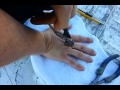 Wart removal with pliers slo-mo