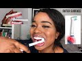 HOW TO BRUSH YOUR TEETH CORRECTLY |  Manual vs Electric Step-By-Step Tutorial